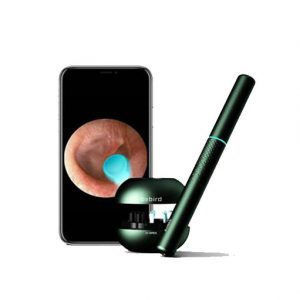 آندوسکوپ گوش شیائومی m9